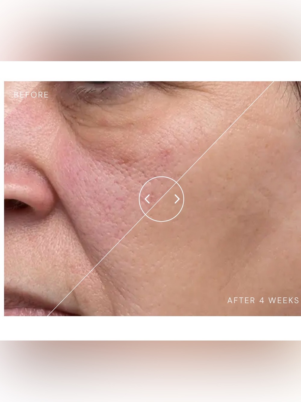 ELEMIS Dynamic Resurfacing Facial Pads - Picture 7 of 7